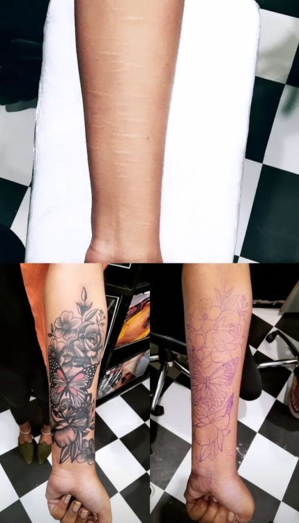 Scar Cover up Tattoo Designs- Bob Tattoo Studio