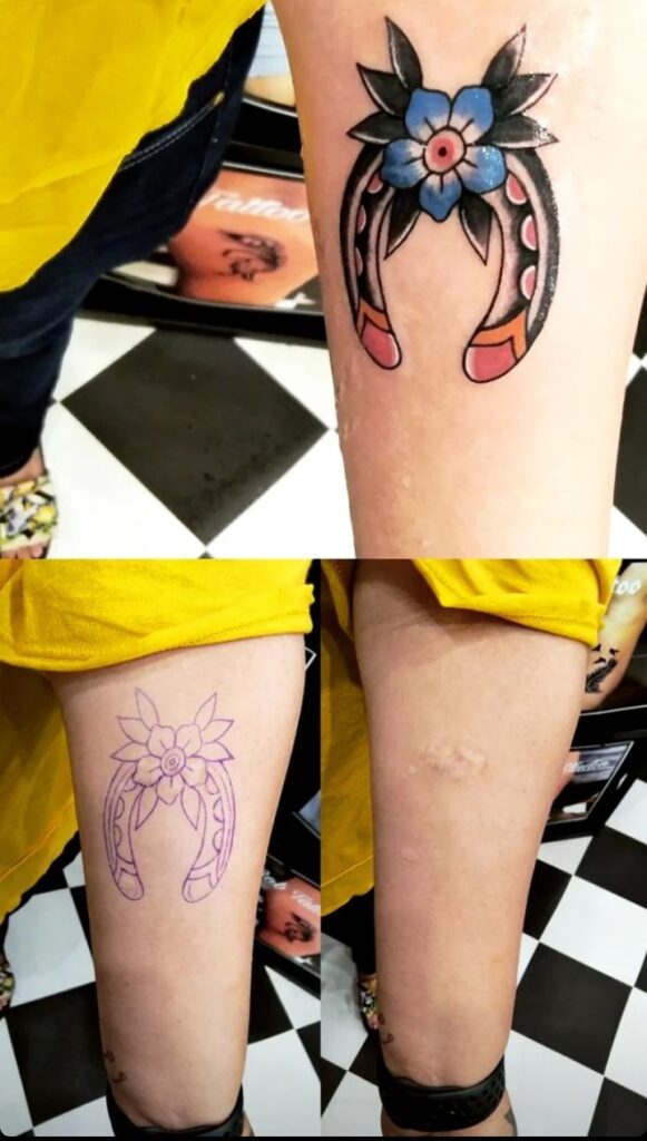 Scar Coverup Tattoo Designs Horsehoe - Bob Tattoo Studio