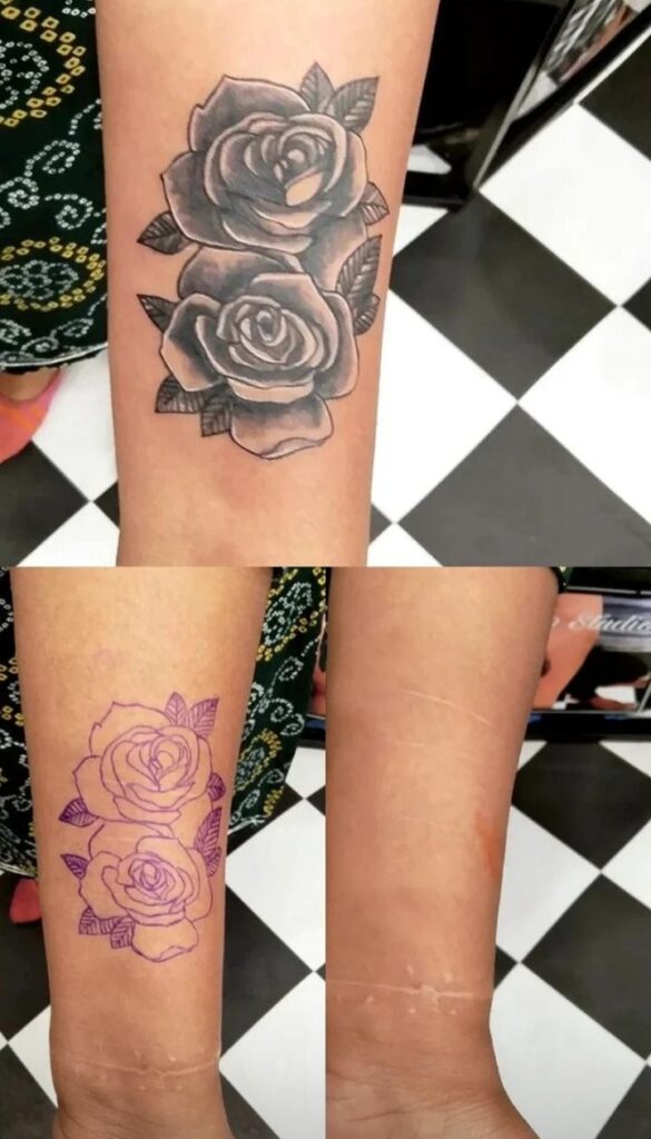 Scar Coverup Tattoo Rose - Bob Tattoo STudio